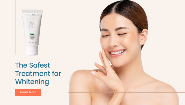 pigmentation-removal-cream-melasma